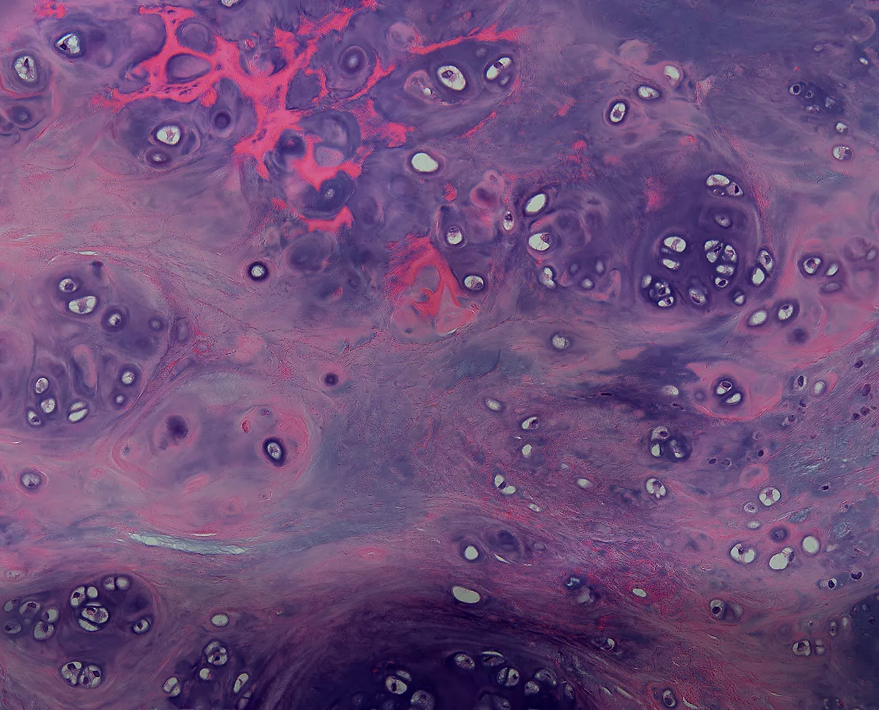 月色星光。软骨组织切片，×100，明视野+ 偏振光，2019