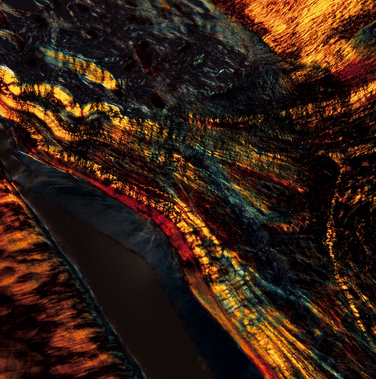 w-1-日出, 骨髓组织切片, X200倍, 明视野, 2012.jpg