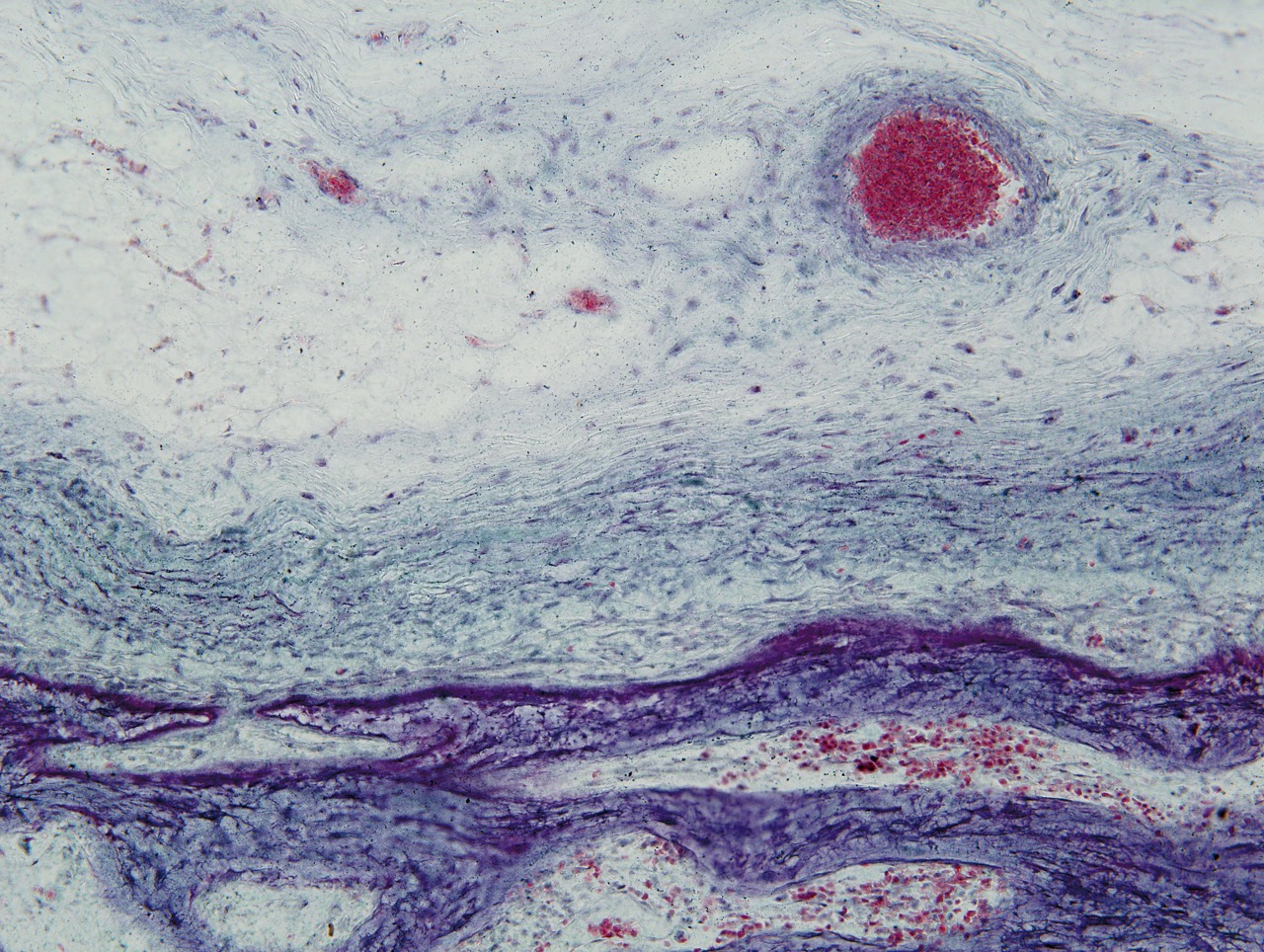 w-1-日出, 骨髓组织切片, X200倍, 明视野, 2012.jpg