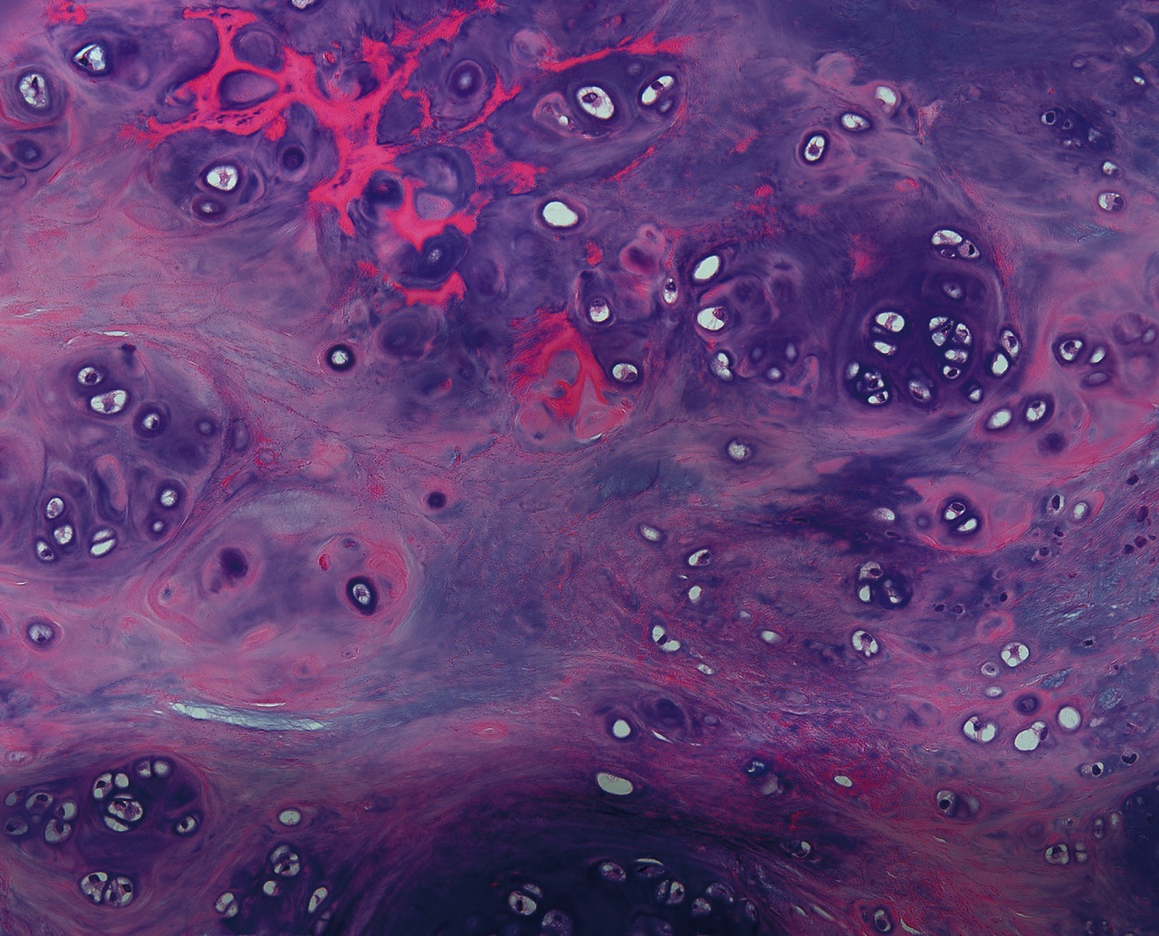 w-16-星空No.3,软骨组织切片,X100倍,明视野+偏振光,2019.jpg