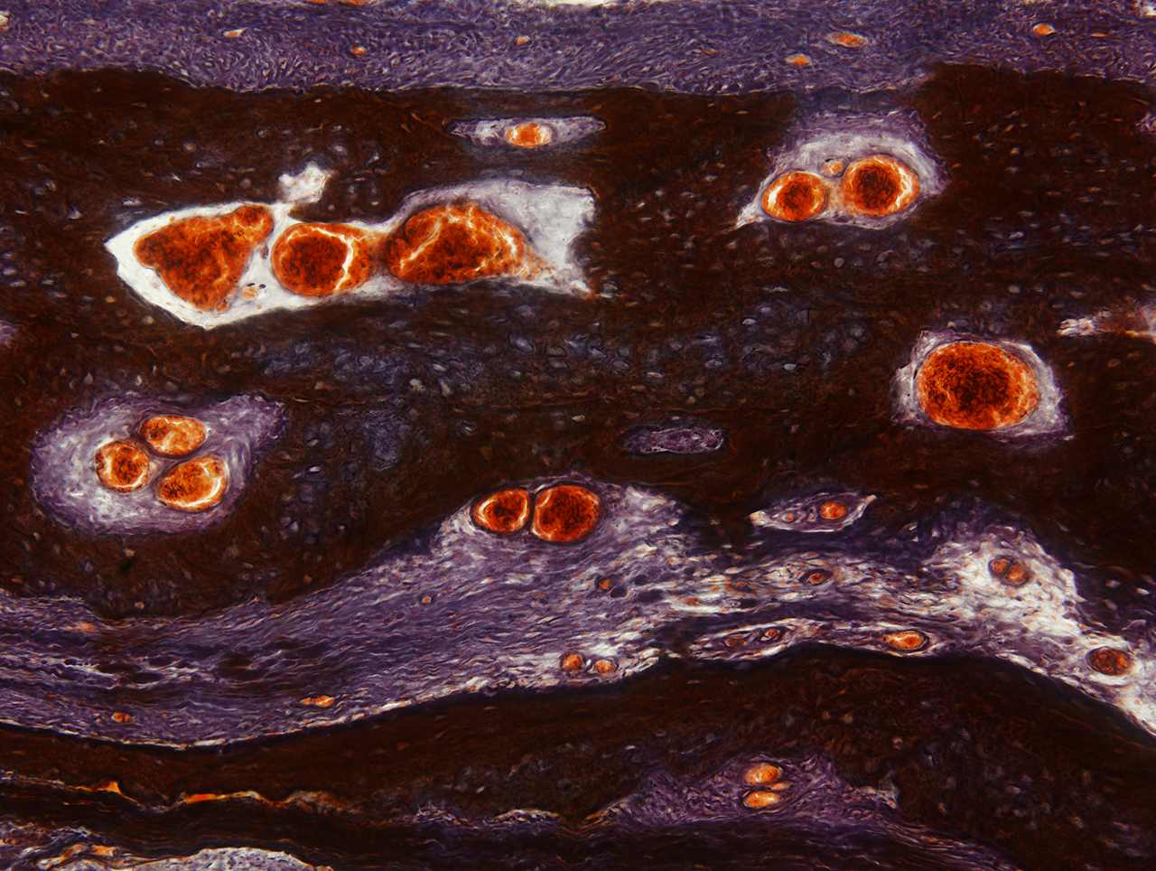 w-1-日出, 骨髓组织切片, X200倍, 明视野, 2012.jpg