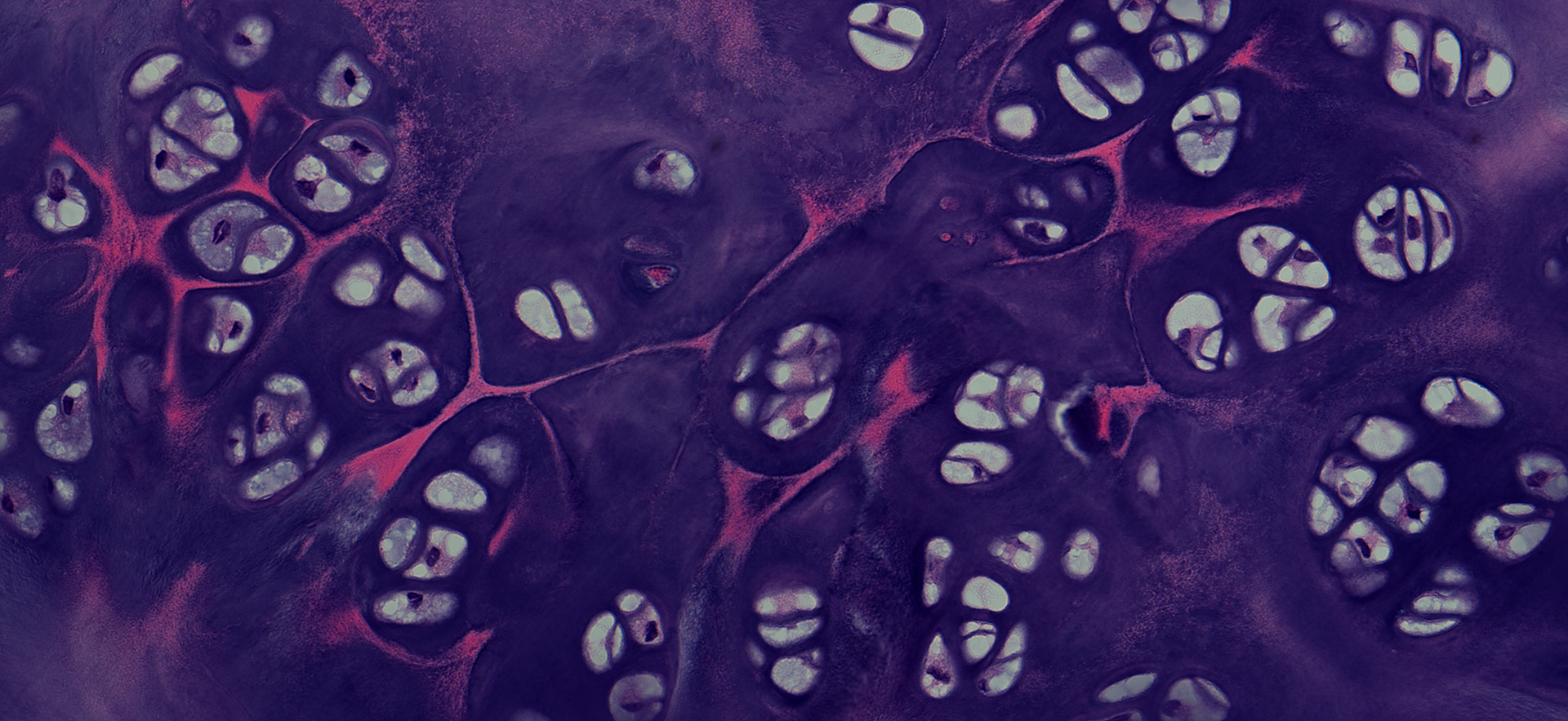 w-1-日出, 骨髓组织切片, X200倍, 明视野, 2012.jpg