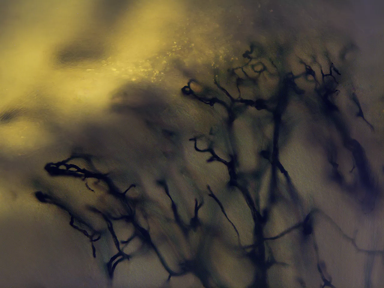 春雨。灌墨血管组织切片，X100，明视野（长时间曝光），2019