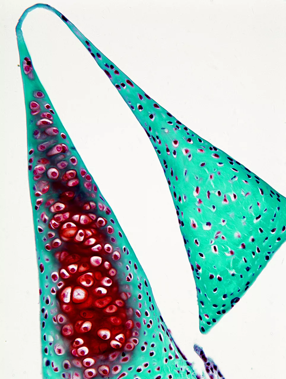 荷影。关节盘软骨组织切片，X40，明视野，2012