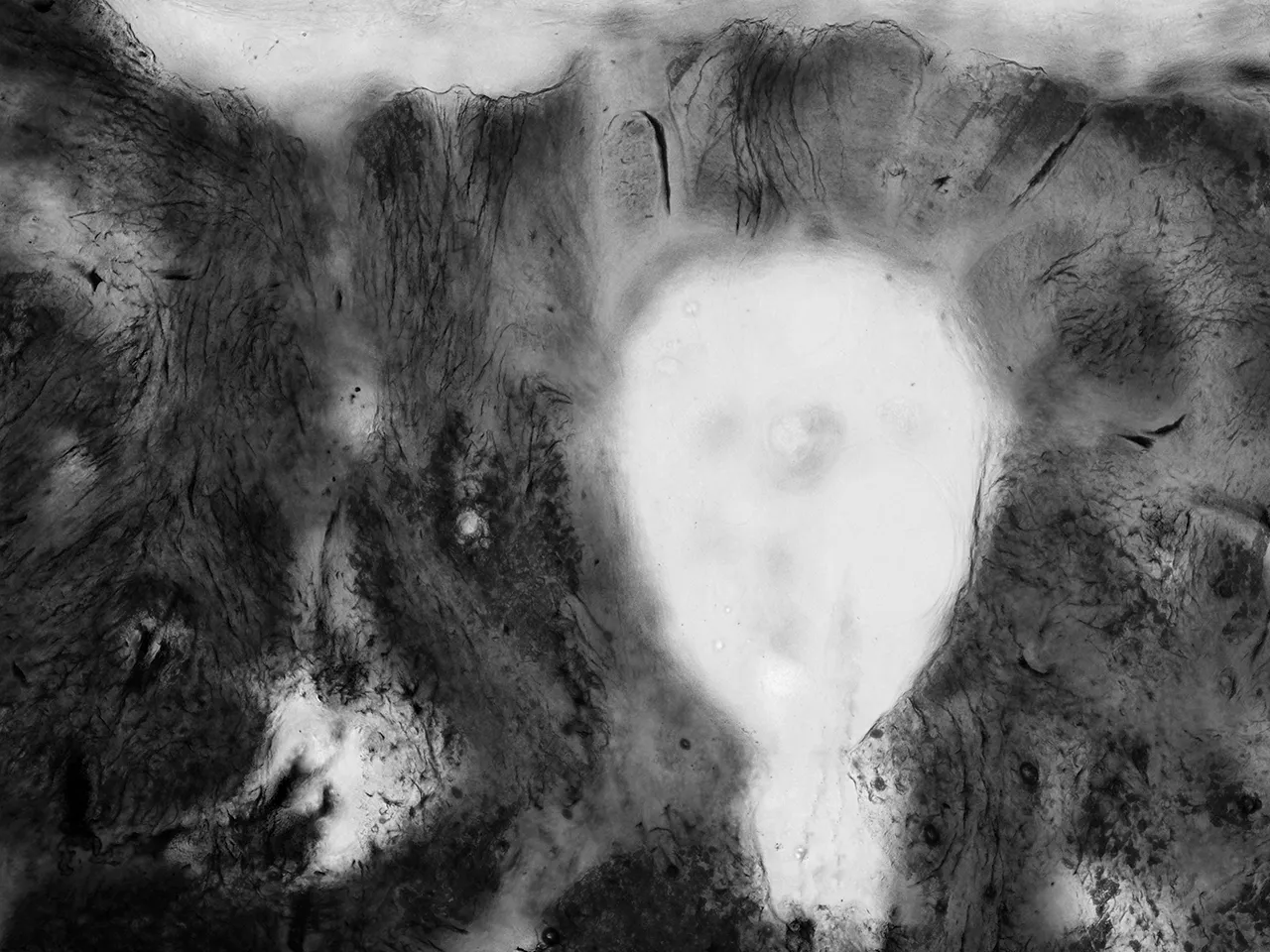 小桥旁边。未脱钙骨组织磨片，X40， 明视野，2013