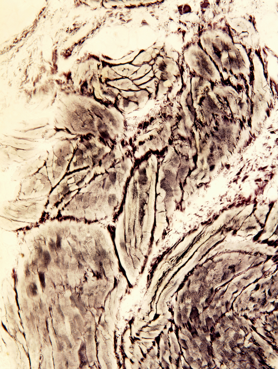 w-1-日出, 骨髓组织切片, X200倍, 明视野, 2012.jpg