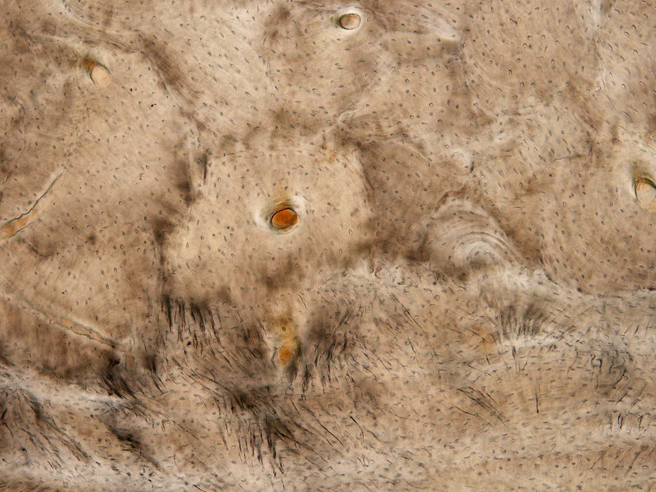 w-1-日出, 骨髓组织切片, X200倍, 明视野, 2012.jpg