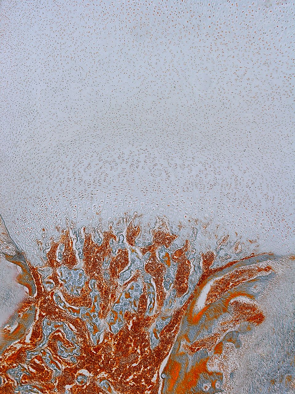 w-1-日出, 骨髓组织切片, X200倍, 明视野, 2012.jpg