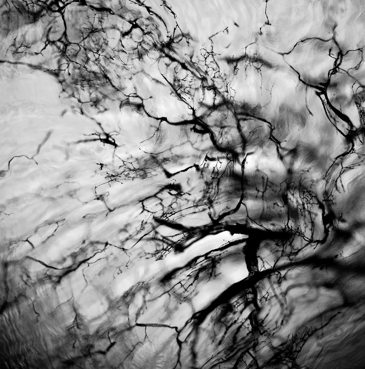 水墨No.1。灌墨血管组织切片，X40，明视野，2011