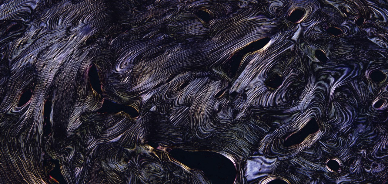 w-1-日出, 骨髓组织切片, X200倍, 明视野, 2012.jpg
