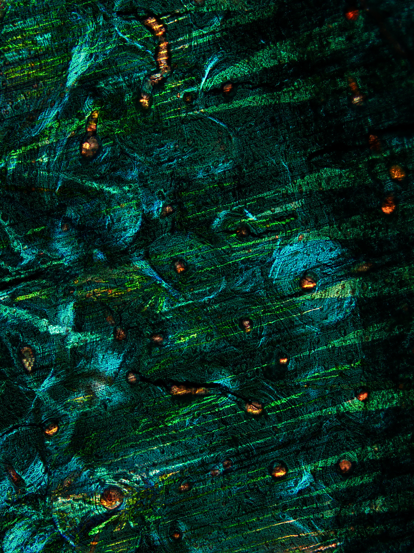 w-1-日出, 骨髓组织切片, X200倍, 明视野, 2012.jpg